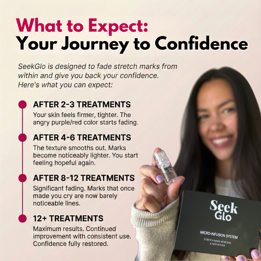 SeekGlo Stretch Mark System