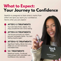SeekGlo Stretch Mark System